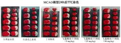 一种飞蓬酸及其提取方法和应用、治疗缺血性脑中风的药物